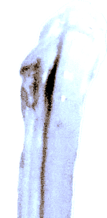 Idarklynch