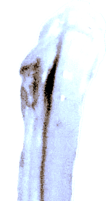 Idarklynch