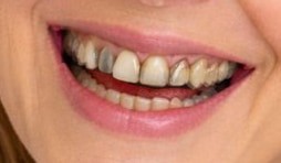 Dental vacation before treatment in 2026